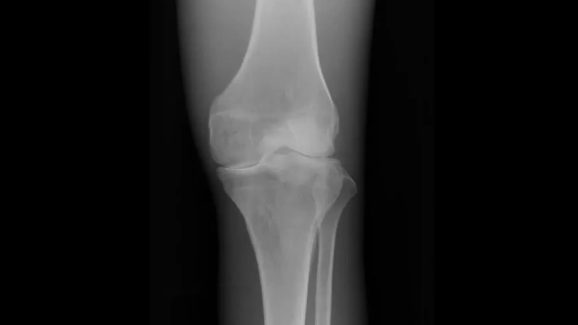 BioDynamix Joint Genesis 